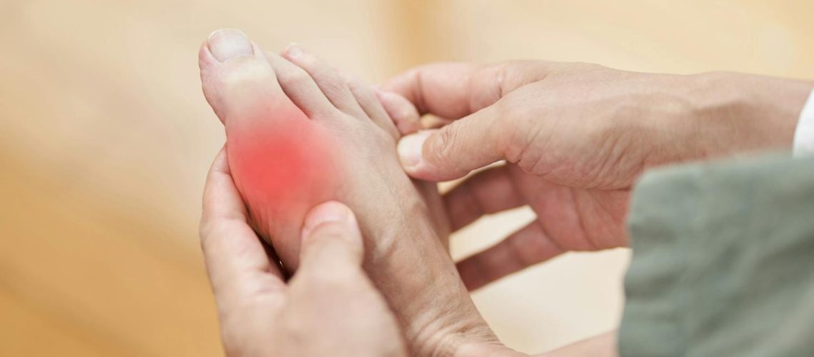 Comment soulager une crise de goutte naturellement ? Comment soulager une crise de goutte naturellement ?