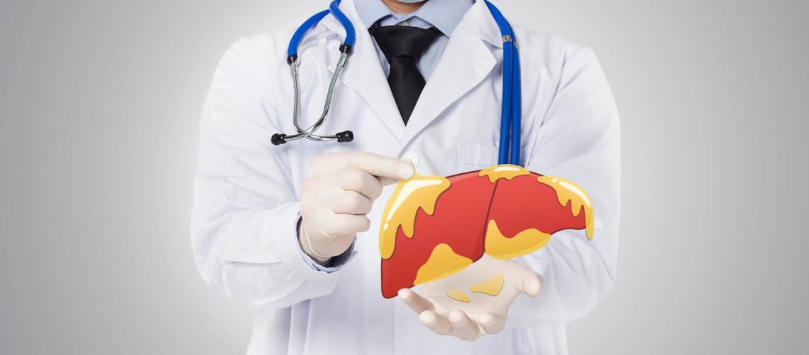 Maladie du foie gras : quel régime est efficace ?